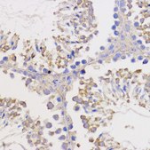Anti-BCL2 antibody produced in rabbit