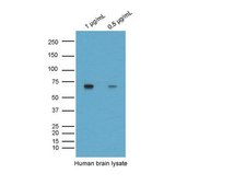 Anti-BACE Antibody, CT Chemicon®, from rabbit
