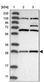Anti-COA7 antibody produced in rabbit Prestige Antibodies® Powered by Atlas Antibodies, affinity isolated antibody, buffered aqueous glycerol solution, ab1