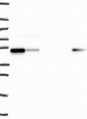 Anti-SNX5 antibody produced in rabbit Prestige Antibodies® Powered by Atlas Antibodies, affinity isolated antibody, buffered aqueous glycerol solution