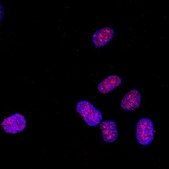 抗单甲基组蛋白H3（Lys4）抗体 Upstate®, from rabbit