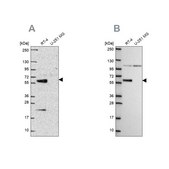 Anti-IRF6 antibody produced in rabbit Prestige Antibodies® Powered by Atlas Antibodies, affinity isolated antibody, buffered aqueous glycerol solution