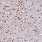 Anti-KCNB1 antibody produced in rabbit Prestige Antibodies® Powered by Atlas Antibodies, affinity isolated antibody, buffered aqueous glycerol solution