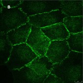 Anti-beta Catenin Antibody, clone 3J7, ZooMAb® Rabbit Monoclonal recombinant, expressed in HEK 293 cells