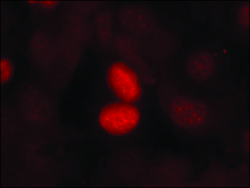 抗-磷酸化-FOXO1 (pSer256) 兔抗 affinity isolated antibody