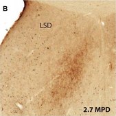 Monoclonal Anti-Tyrosine Hydroxylase antibody produced in mouse clone TH-16, ascites fluid