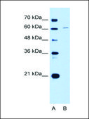Anti-CDT1 antibody produced in rabbit affinity isolated antibody