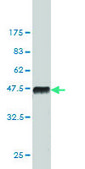 Monoclonal Anti-SIRT2 antibody produced in mouse clone 4B11, purified immunoglobulin, buffered aqueous solution