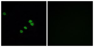 Anti-SP1 antibody produced in rabbit affinity isolated antibody