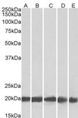 Anti-FTL antibody produced in goat affinity isolated antibody, buffered aqueous solution