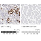 Anti-CALB1 antibody produced in rabbit Prestige Antibodies® Powered by Atlas Antibodies, affinity isolated antibody, buffered aqueous glycerol solution
