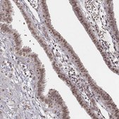 Anti-HMGA2 antibody produced in rabbit Prestige Antibodies® Powered by Atlas Antibodies, affinity isolated antibody, buffered aqueous glycerol solution