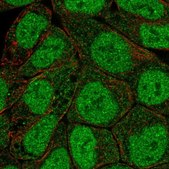 Anti-PRKCB antibody produced in rabbit Prestige Antibodies® Powered by Atlas Antibodies, affinity isolated antibody, buffered aqueous glycerol solution
