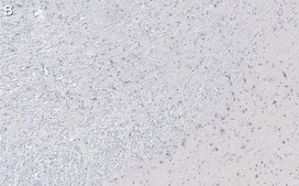 Anti-Tyrosine Hydroxylase Antibody, clone 2/40/15 ZooMAb® Mouse Monoclonal recombinant, expressed in HEK 293 cells