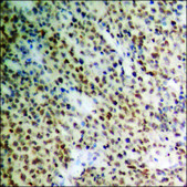 Anti-phospho-STAT2 (pTyr690) antibody produced in rabbit affinity isolated antibody