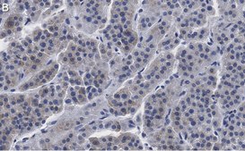 Anti-CXCR4 Antibody, clone 2L2, ZooMAb® Rabbit Monoclonal recombinant, expressed in HEK 293 cells