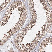 Anti-KTN1 antibody produced in rabbit Prestige Antibodies® Powered by Atlas Antibodies, affinity isolated antibody, buffered aqueous glycerol solution