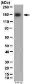Anti-Protein patched homolog 1 Antibody from rabbit, purified by affinity chromatography