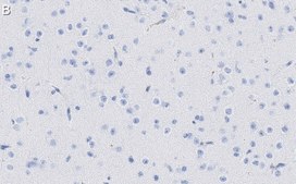Anti-MAP2 Antibody, clone AP20 ZooMAb® Mouse Monoclonal recombinant, expressed in HEK 293 cells