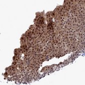 Anti-UBC antibody produced in rabbit Prestige Antibodies® Powered by Atlas Antibodies, affinity isolated antibody, buffered aqueous glycerol solution