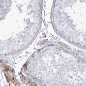 Anti-HYAL2 antibody produced in rabbit Prestige Antibodies® Powered by Atlas Antibodies, affinity isolated antibody, buffered aqueous glycerol solution