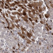 Anti-CRP antibody produced in rabbit Prestige Antibodies® Powered by Atlas Antibodies, affinity isolated antibody, buffered aqueous glycerol solution, Ab1