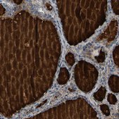 Anti-PDE1A antibody produced in rabbit Prestige Antibodies® Powered by Atlas Antibodies, affinity isolated antibody, buffered aqueous glycerol solution