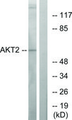 Anti-AKT2 antibody produced in rabbit affinity isolated antibody