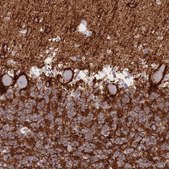 Anti-ATP1A3 antibody produced in rabbit Prestige Antibodies® Powered by Atlas Antibodies, affinity isolated antibody, buffered aqueous glycerol solution