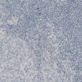 Monoclonal Anti-MBP antibody produced in mouse Prestige Antibodies® Powered by Atlas Antibodies, clone CL2819, purified immunoglobulin, buffered aqueous glycerol solution