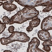 Monoclonal Anti-EZR antibody produced in mouse Prestige Antibodies® Powered by Atlas Antibodies, clone CL2360, purified immunoglobulin, buffered aqueous glycerol solution