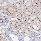 抗-DPY30 兔抗 Prestige Antibodies® Powered by Atlas Antibodies, affinity isolated antibody, buffered aqueous glycerol solution