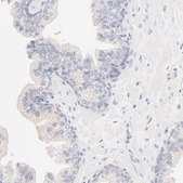 Anti-SPTB antibody produced in rabbit Ab1, Prestige Antibodies® Powered by Atlas Antibodies, affinity isolated antibody, buffered aqueous glycerol solution