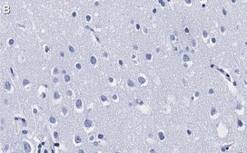 Anti-HDAC3 Antibody, clone 1H19 ZooMAb® Rabbit Monoclonal recombinant, expressed in HEK 293 cells