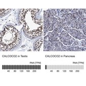 Anti-CALCOCO2 antibody produced in rabbit Prestige Antibodies® Powered by Atlas Antibodies, affinity isolated antibody, buffered aqueous glycerol solution, Ab2