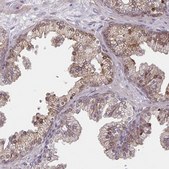 Anti-TNFSF10 antibody produced in rabbit Prestige Antibodies® Powered by Atlas Antibodies, affinity isolated antibody, buffered aqueous glycerol solution