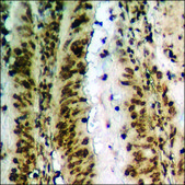 Anti-phospho-HDAC2 (pSer394) antibody produced in rabbit affinity isolated antibody