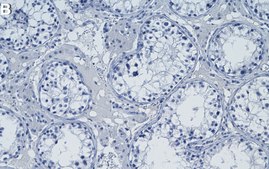 Anti-β Tubulin Antibody, clone AA2 ZooMAb® Mouse Monoclonal recombinant, expressed in HEK 293 cells