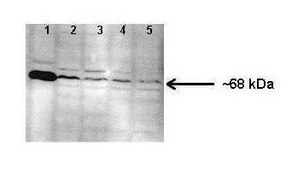 Anti-CYP1B1 affinity isolated antibody