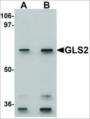 Anti-GLS2 antibody produced in rabbit affinity isolated antibody