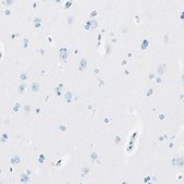 Anti-MFAP5 antibody produced in rabbit Prestige Antibodies® Powered by Atlas Antibodies, affinity isolated antibody, buffered aqueous glycerol solution