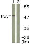 Anti-p53 antibody produced in rabbit affinity isolated antibody