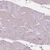 Anti-FASN antibody produced in rabbit Prestige Antibodies® Powered by Atlas Antibodies, affinity isolated antibody, buffered aqueous glycerol solution
