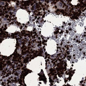 Anti-Elane Antibody Produced In Rabbit Prestige Antibodies® Powered by Atlas Antibodies, affinity isolated antibody, buffered aqueous glycerol solution