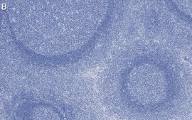 Anti-Talin-1 Antibody, clone 2F8 ZooMAb® Rabbit Monoclonal recombinant, expressed in HEK 293 cells