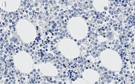 Anti-UTX Antibody, clone 4G9 ZooMAb® Rabbit Monoclonal recombinant, expressed in HEK 293 cells