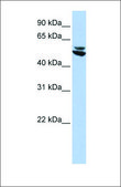 Anti-KRT7 antibody produced in rabbit affinity isolated antibody