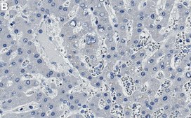 Anti-pro-Cathepsin D Antibody, clone 1D16 ZooMAb® Rabbit Monoclonal recombinant, expressed in HEK 293 cells