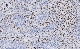 Anti-p21 Antibody, clone 5G7, ZooMAb® Rabbit Monoclonal recombinant, expressed in HEK 293 cells