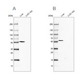 Anti-FTCD antibody produced in rabbit Prestige Antibodies® Powered by Atlas Antibodies, affinity isolated antibody, buffered aqueous glycerol solution